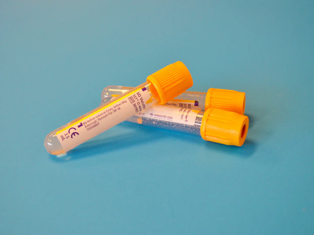 blood test tubes